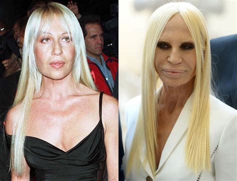 donatella versace allegra versace|Donatella Versace before and after surgery.